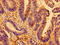 Adenosine Monophosphate Deaminase 2 antibody, CSB-PA001681LA01HU, Cusabio, Immunohistochemistry frozen image 