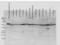 Prolyl 4-Hydroxylase Subunit Beta antibody, 11081, QED Bioscience, Western Blot image 