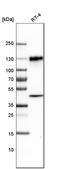 Lysosomal Associated Membrane Protein 1 antibody, AMAb91300, Atlas Antibodies, Western Blot image 