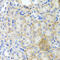 Peroxisomal Biogenesis Factor 3 antibody, 22-885, ProSci, Immunohistochemistry paraffin image 