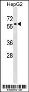 Zinc Finger Protein 419 antibody, 59-535, ProSci, Western Blot image 