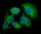 Thymidylate Synthetase antibody, GTX57572, GeneTex, Immunocytochemistry image 