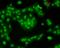 Calcium/calmodulin-dependent protein kinase type II subunit beta antibody, SMC-124D-A633, StressMarq, Immunofluorescence image 