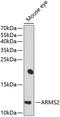 Age-Related Maculopathy Susceptibility 2 antibody, 13-474, ProSci, Western Blot image 