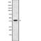 Death Associated Protein Kinase 2 antibody, abx149732, Abbexa, Western Blot image 