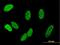 Chromosome Alignment Maintaining Phosphoprotein 1 antibody, H00283489-B01P, Novus Biologicals, Immunocytochemistry image 