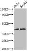 Protein Kinase CAMP-Activated Catalytic Subunit Gamma antibody, CSB-PA018690LA01HU, Cusabio, Western Blot image 