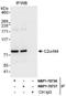 WD Repeat And Coiled Coil Containing antibody, NBP1-78736, Novus Biologicals, Immunoprecipitation image 