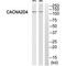 Calcium Voltage-Gated Channel Auxiliary Subunit Alpha2delta 4 antibody, PA5-50163, Invitrogen Antibodies, Western Blot image 