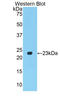 Matrix Metallopeptidase 12 antibody, LS-C305182, Lifespan Biosciences, Western Blot image 