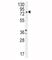 Dopamine Beta-Hydroxylase antibody, F41304-0.4ML, NSJ Bioreagents, Western Blot image 