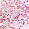 H1 Histone Family Member 0 antibody, LS-C353993, Lifespan Biosciences, Immunohistochemistry paraffin image 