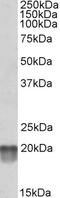 NADH:Ubiquinone Oxidoreductase Core Subunit S7 antibody, orb20608, Biorbyt, Western Blot image 