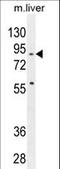 Spire Type Actin Nucleation Factor 2 antibody, LS-C161457, Lifespan Biosciences, Western Blot image 