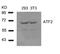 Activating Transcription Factor 2 antibody, 79-276, ProSci, Western Blot image 