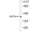 GATA Binding Protein 4 antibody, LS-C176765, Lifespan Biosciences, Western Blot image 