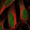 Acid Phosphatase antibody, NBP1-89551, Novus Biologicals, Immunofluorescence image 