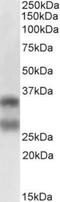 TNF Superfamily Member 11 antibody, GTX13582, GeneTex, Western Blot image 