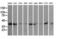 Pim-2 Proto-Oncogene, Serine/Threonine Kinase antibody, GTX83886, GeneTex, Western Blot image 