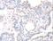 Apurinic/Apyrimidinic Endodeoxyribonuclease 1 antibody, LS-C400548, Lifespan Biosciences, Immunohistochemistry paraffin image 