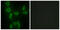 Isoleucyl-TRNA Synthetase 2, Mitochondrial antibody, GTX87187, GeneTex, Immunofluorescence image 