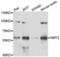 N-Myristoyltransferase 2 antibody, LS-C346201, Lifespan Biosciences, Western Blot image 