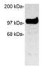 Discs Large MAGUK Scaffold Protein 3 antibody, GTX23438, GeneTex, Western Blot image 