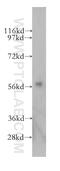 Cytochrome P450 Family 46 Subfamily A Member 1 antibody, 12486-1-AP, Proteintech Group, Western Blot image 