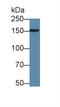 Apolipoprotein B antibody, LS-C292897, Lifespan Biosciences, Western Blot image 