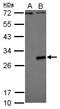 Dengue virus antibody, GTX113375, GeneTex, Western Blot image 