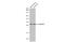 Twist Family BHLH Transcription Factor 1 antibody, GTX127310, GeneTex, Western Blot image 