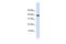 Chondromodulin antibody, GTX46674, GeneTex, Western Blot image 