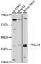 Protein Kinase CAMP-Activated Catalytic Subunit Beta antibody, GTX54564, GeneTex, Western Blot image 