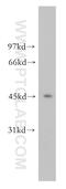 Origin Recognition Complex Subunit 4 antibody, 13026-1-AP, Proteintech Group, Western Blot image 