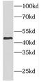 Forkhead Box O4 antibody, FNab03204, FineTest, Western Blot image 