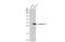 Galectin 3 antibody, GTX635152, GeneTex, Western Blot image 