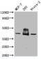 Sphingosine-1-Phosphate Receptor 2 antibody, CSB-PA020651LA01HU, Cusabio, Western Blot image 