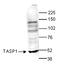 Taspase 1 antibody, TA347304, Origene, Western Blot image 