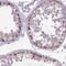 Cancer/Testis Antigen 2 antibody, NBP2-49659, Novus Biologicals, Immunohistochemistry frozen image 