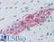 Ribosomal Protein S6 Kinase B1 antibody, LS-B6145, Lifespan Biosciences, Immunohistochemistry frozen image 