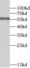 Serine/Threonine Kinase 4 antibody, FNab08339, FineTest, Western Blot image 