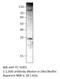 ATP Binding Cassette Subfamily C Member 8 antibody, MBS540584, MyBioSource, Western Blot image 