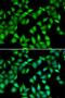 Myosin Light Chain 3 antibody, LS-C334859, Lifespan Biosciences, Immunofluorescence image 