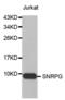 Small Nuclear Ribonucleoprotein Polypeptide G antibody, abx003037, Abbexa, Western Blot image 