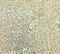 IKAROS Family Zinc Finger 2 antibody, 8117, ProSci, Immunohistochemistry paraffin image 