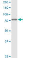 Forkhead Box K2 antibody, LS-B14828, Lifespan Biosciences, Western Blot image 