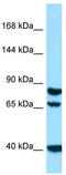 Signal Peptide, CUB Domain And EGF Like Domain Containing 1 antibody, TA337797, Origene, Western Blot image 