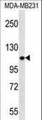 Actinin Alpha 3 (Gene/Pseudogene) antibody, LS-B9666, Lifespan Biosciences, Western Blot image 