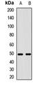 Ectodysplasin A Receptor antibody, LS-C668606, Lifespan Biosciences, Western Blot image 