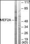 Myocyte Enhancer Factor 2A antibody, orb95921, Biorbyt, Western Blot image 